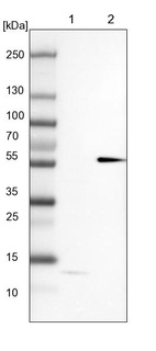 Anti-MKS1 Antibody