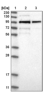 Anti-LRCH1 Antibody