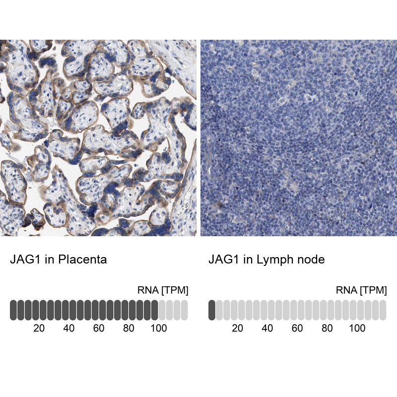 Anti-JAG1 Antibody