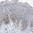 Immunohistochemical staining of human skin shows weak cytoplasmic positivity in squamous epithelial cells.