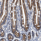 Immunohistochemical staining of human duodenum shows moderate cytoplasmic and membranous positivity in glandular cells.