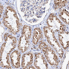 Anti-TRIM65 Antibody