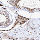 Anti-TRIM65 Antibody