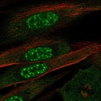 Anti-EFCAB13 Antibody