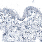 Anti-RCOR2 Antibody