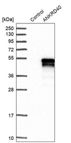 Anti-ANKRD40 Antibody