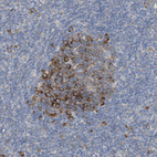 Anti-UBAP2 Antibody