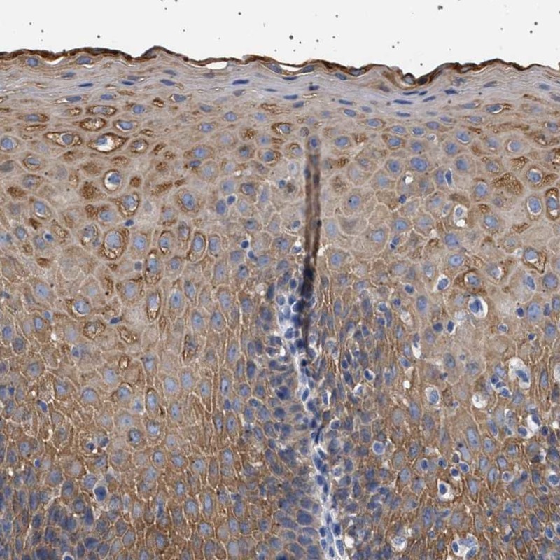 Anti-TRMT10B Antibody