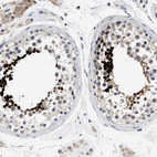 Anti-ACTL7B Antibody