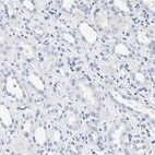 Anti-ACTL7B Antibody