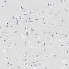 Anti-ACTL7B Antibody