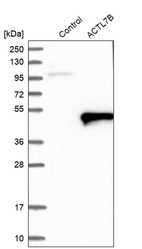 Anti-ACTL7B Antibody