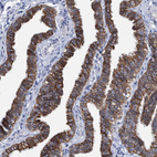 Anti-MKS1 Antibody