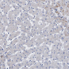 Anti-MKS1 Antibody