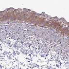 Anti-HSD17B2 Antibody