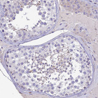 Anti-HSD17B2 Antibody