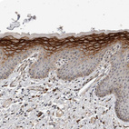 Anti-CYSRT1 Antibody