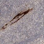 Anti-CYSRT1 Antibody