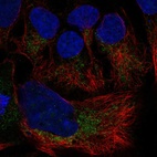 Anti-SLC25A19 Antibody