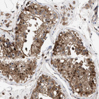 Anti-TP53I3 Antibody