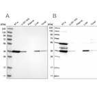 Anti-TP53I3 Antibody