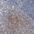 Anti-ARPC5L Antibody