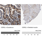 Anti-CDR2L Antibody