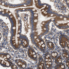 Anti-CDR2L Antibody