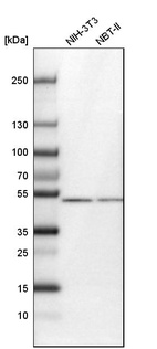 Anti-CDR2L Antibody