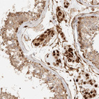 Anti-KIF9 Antibody