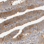 Anti-KIF9 Antibody