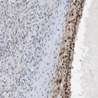 Anti-POLR1E Antibody