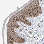 Anti-POLR1E Antibody