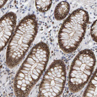 Anti-POLR1E Antibody