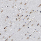 Anti-POLR1E Antibody