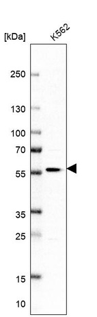 Anti-POLR1E Antibody