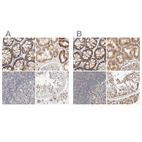 Anti-MRM3 Antibody