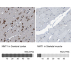 Anti-NMT1 Antibody