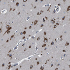 Anti-NMT1 Antibody