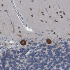 Anti-NMT1 Antibody