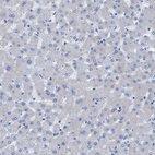 Anti-NMT1 Antibody