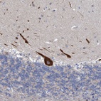 Anti-RSAD1 Antibody