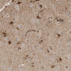 Anti-SLFN14 Antibody