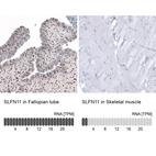 Anti-SLFN11 Antibody