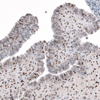 Anti-SLFN11 Antibody