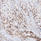 Anti-SLFN11 Antibody