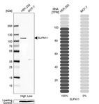 Anti-SLFN11 Antibody