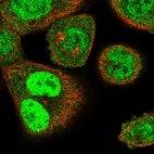 Anti-SLFN11 Antibody