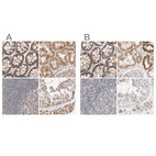 Anti-MRM3 Antibody