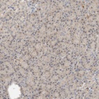 Anti-MRM3 Antibody